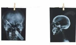 Sunstar Garland-torture X-ray 63 In. Decorations & Props